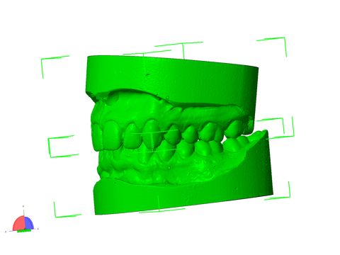 3D Dental Scan